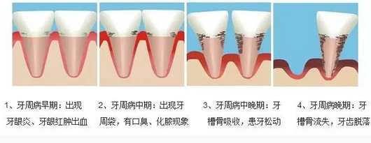 微信截图_20161220105322.png