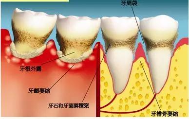 918博天堂阳光口腔超多全科诊疗福利