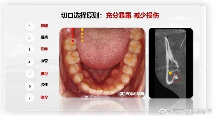 董智伟博士应邀参加中华口腔医学会继教项目并进行病例汇报